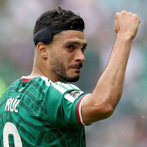 ¿Qué usa Raúl Jiménez en la cabeza durante los partidos? (Foto: Getty)