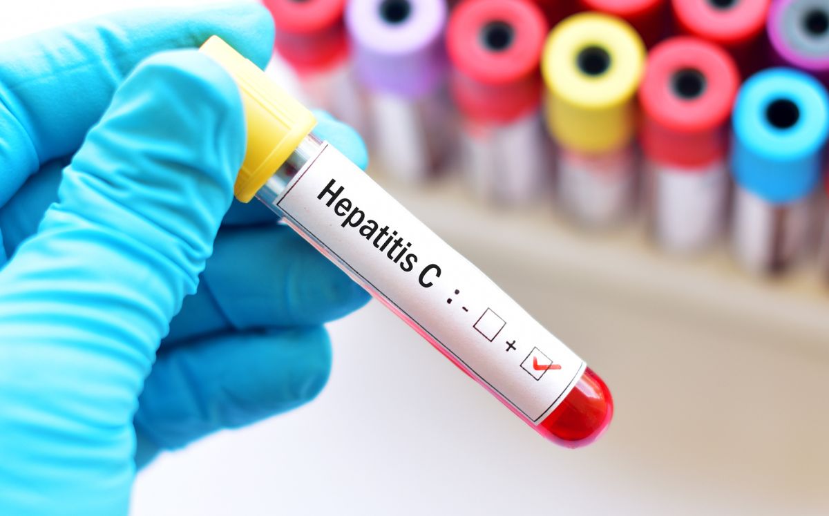 Hepatitis C: Señales de alerta, pruebas y tratamiento (Foto: Getty)