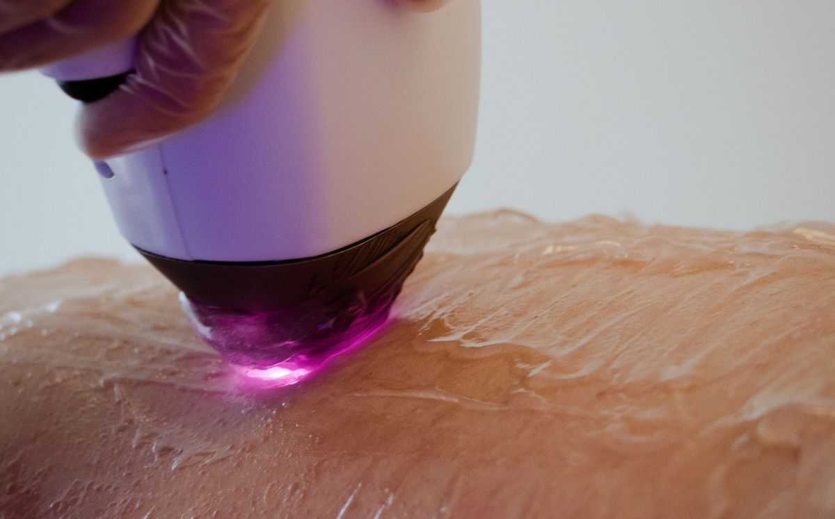 Cofepris alerta por depiladoras de luz falsas; conoce los riesgos de su compra y uso (Foto: Pexels)