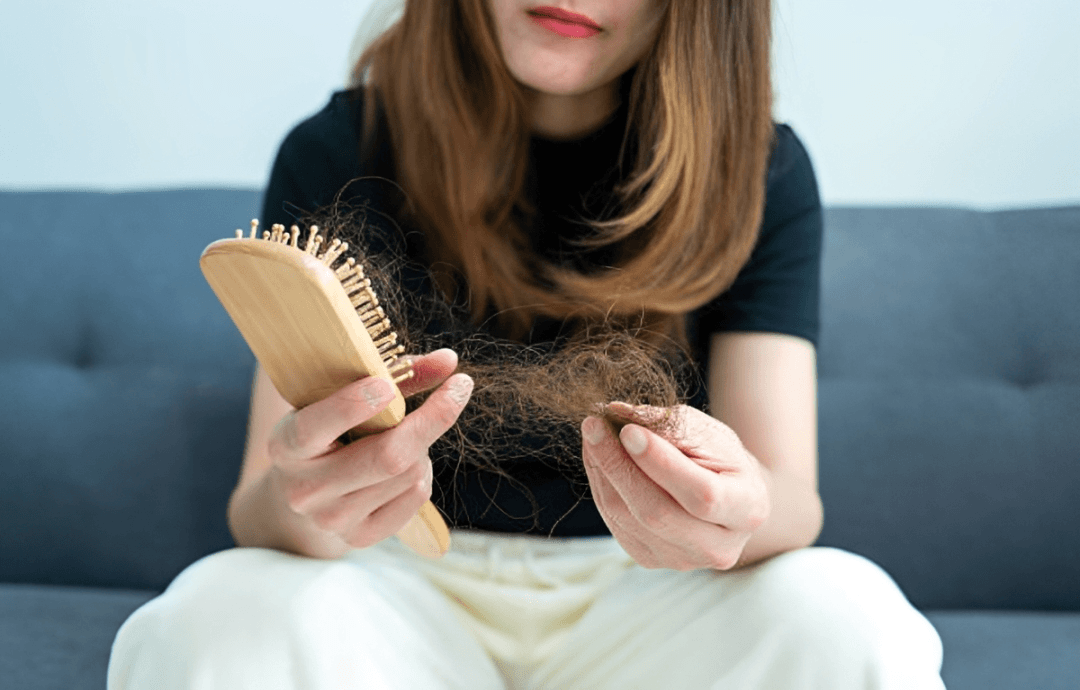 Perdida de cabello (Imagen Getty)