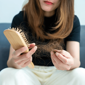 Perdida de cabello (Imagen Getty)